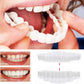 Smile Veneer (Upper & Lower Included)