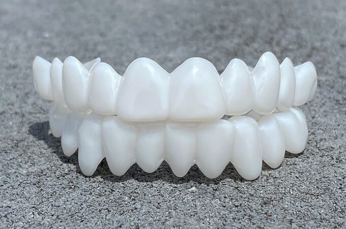 Hudson & Jurgen – Opklikbare tandfineers met aangepaste pasvorm voor een natuurlijke glimlach