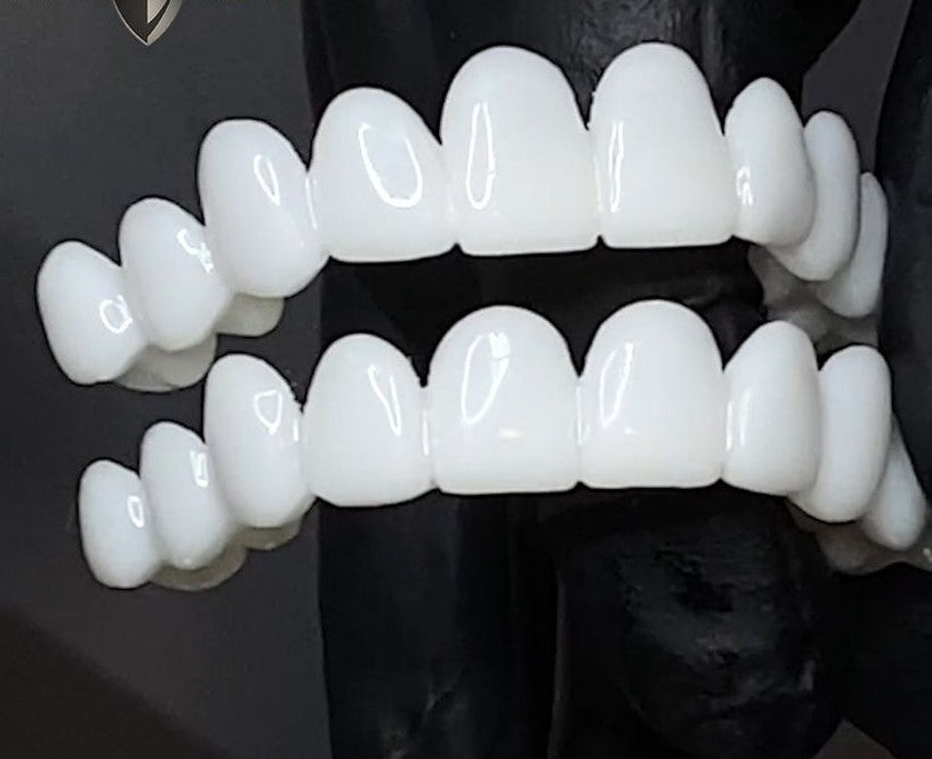 Hudson & Jurgen – Opklikbare tandfineers met aangepaste pasvorm voor een natuurlijke glimlach